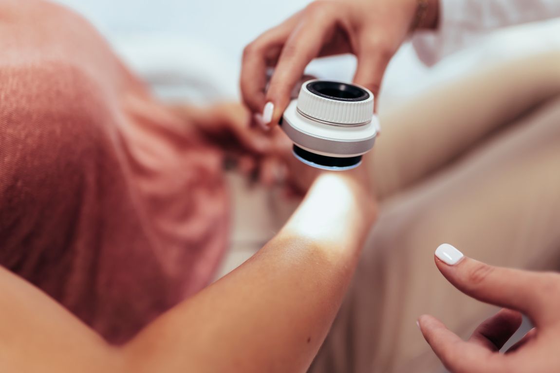 skin cancer evaluation